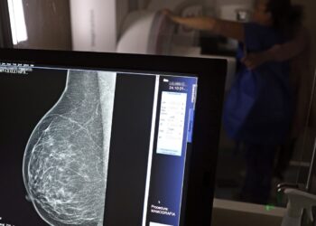 AGU processa médico que apontou mamografia como causadora de câncer