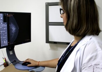 ANS: rastreio do câncer de mama deve ser feito a partir dos 40 anos