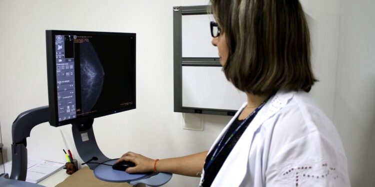 ANS: rastreio do câncer de mama deve ser feito a partir dos 40 anos