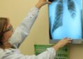 Baixo financiamento mundial ameaça combate à tuberculose