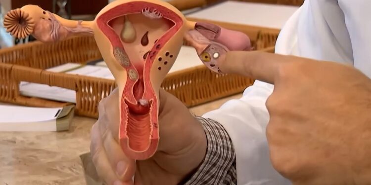 Endometriose: conheça os sintomas e saiba como tratar a doença