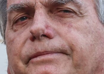 Bolsonaro apresenta piora clínica e vai passar por novos exames