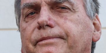 Bolsonaro apresenta piora clínica e vai passar por novos exames