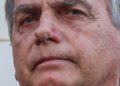 Equipe médica de Bolsonaro descarta complicações pós-cirúrgicas