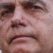 Equipe médica de Bolsonaro descarta complicações pós-cirúrgicas