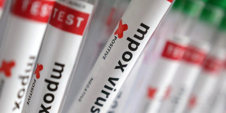 Região Norte do Brasil registra casos de mpox