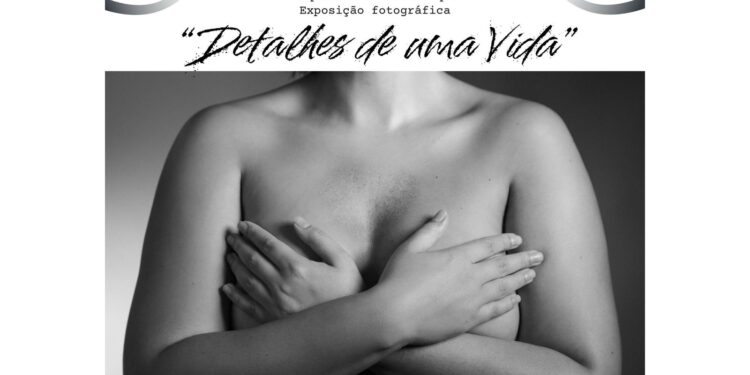 Icesp faz exposição fotográfica sobre cuidados e prevenção do câncer