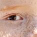 Reflexo branco nos olhos: entenda condição que assusta pais