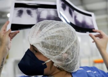 Câncer de pulmão: 15% dos casos acontecem em não fumantes