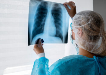 campanha para prevenir câncer de pulmão agora é lei — Senado Notícias