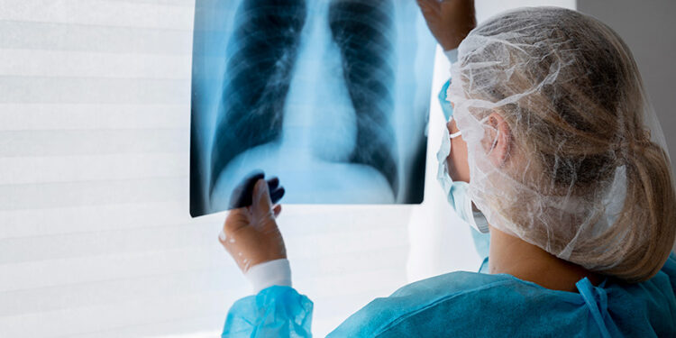 campanha para prevenir câncer de pulmão agora é lei — Senado Notícias