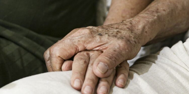 Demência por corpos de Lewy: entenda doença de Milton Nascimento