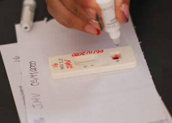 Ação no DF oferece testagem rápida e informação sobre HIV/Aids