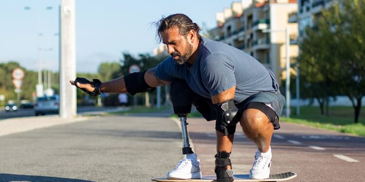 Dia de conscientização sobre ausência de membros, em 25 de agosto, vira lei — Senado Notícias