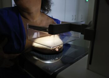Vigitel: 92% das brasileiras entre 50 e 69 anos fizeram mamografia