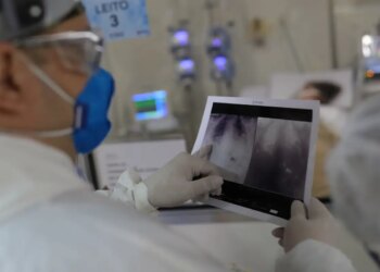 Broncopneumonia: entenda quadro que causou internação de Bolsonaro