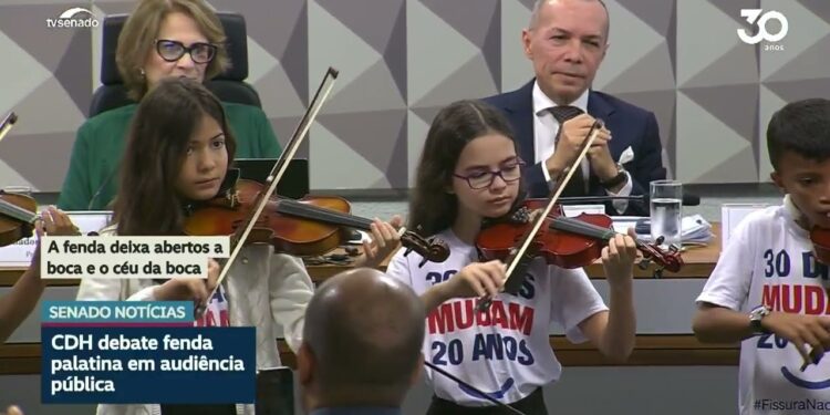 Debatedores na CDH pedem mais atenção do SUS à fissura labiopalatina em bebês — Senado Notícias